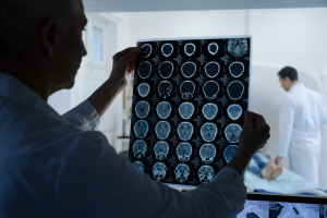 Especialista advierte que tumores cerebrales benignos también pueden poner en riesgo la salud